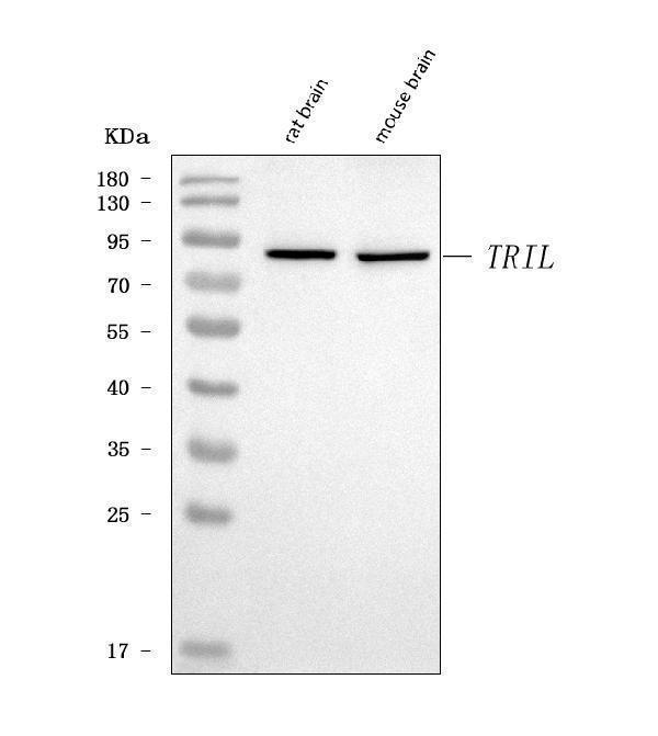  Western blot analysis of TRIL using anti-TRIL antibody (A09398-1)