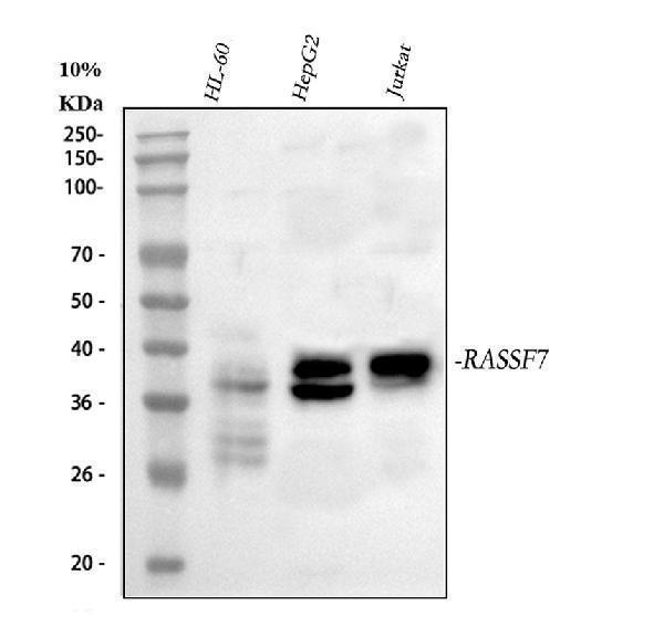  Western blot analysis of RASSF7 using anti-RASSF7 antibody (A09402-2)
