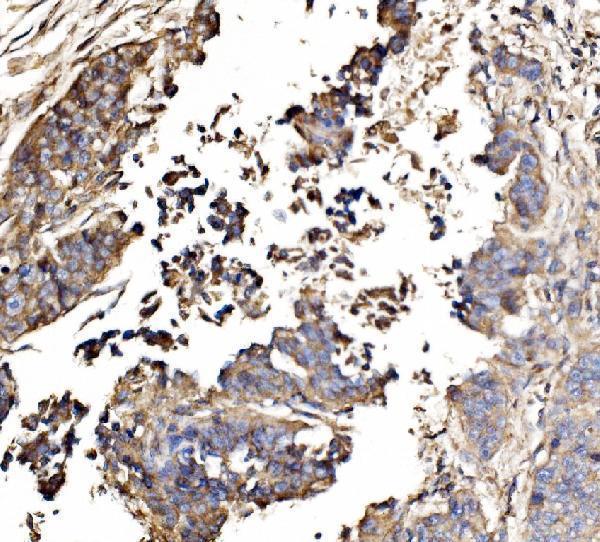  IHC analysis of GNAL using anti-GNAL antibody (A09404-1)