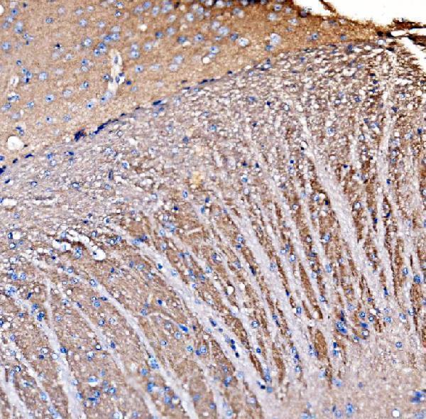 a09404 1 gnal primary antibodies ihc testing 3