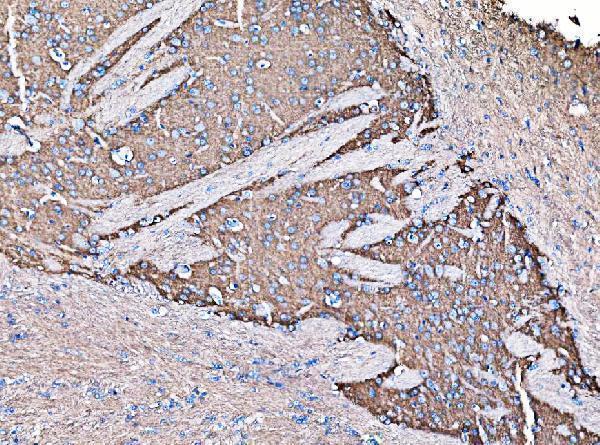 a09404 1 gnal primary antibodies ihc testing 4