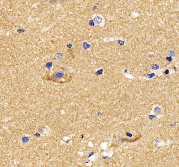 IHC analysis of GNAL using anti-GNAL antibody (A09404-1)
