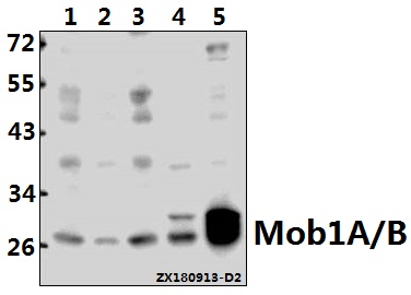 Western blot (WB) analysis of Mob1A/B (D127) polyclonal antibody at 1:500 dilution
Lane1:Hela whole cell lysate(40ug)
Lane2:H1792 whole cell lysate(20ug)
Lane3:HCT116 whole cell lysate(40ug)
Lane4:CT26 whole cell lysate(40ug)
Lane5:PMVEC whole cell lysate(40ug)