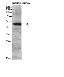 Western blot analysis of mouse-lung mouse-heart 293T Hela 3T3 lysate, antibody was diluted at 500