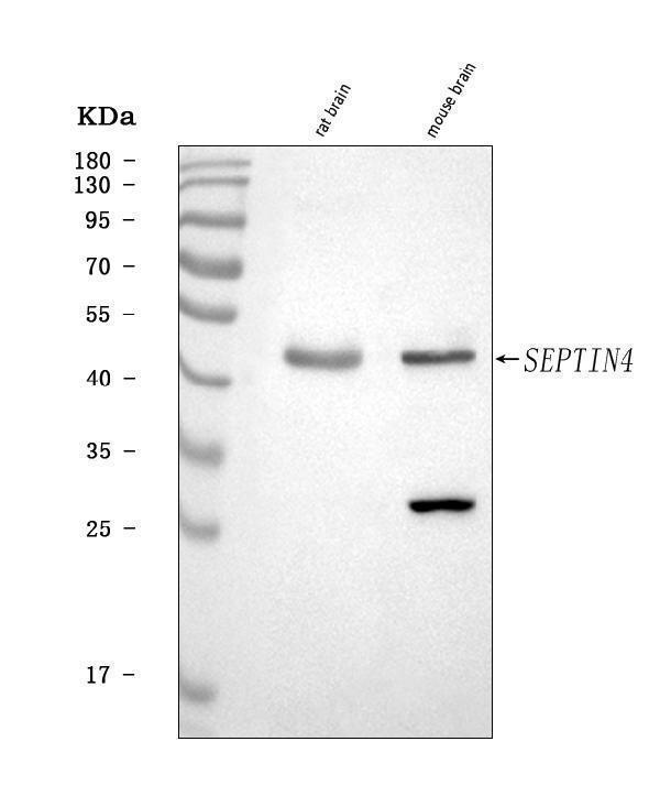  Western blot analysis of SEPT4/SEPTIN4 using anti-SEPT4/SEPTIN4 antibody (A09411-2)