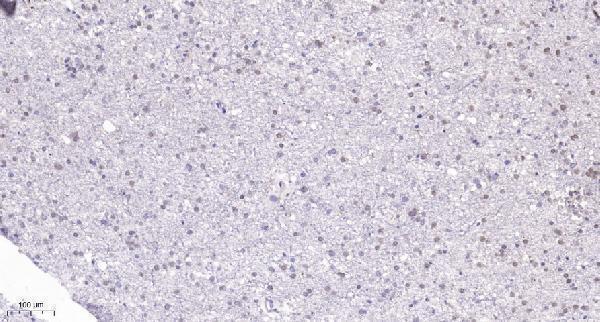 a09415 gnl3l primary antibodies ihc testing 1