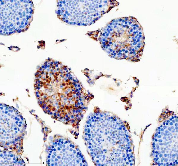 IHC analysis of ODAM using anti-ODAM antibody (A09416)