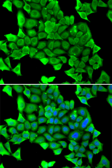 Immunohistochemistry of paraffin-embedded Human skeletal muscle using MYH1 Rabbit pAb  at dilution of 1:50 