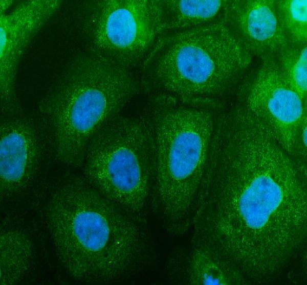 a09421 1 evpl primary antibodies if testing 1
