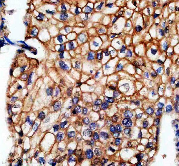 IHC analysis of Envoplakin/EVPL using anti-Envoplakin/EVPL antibody (A09421-1)