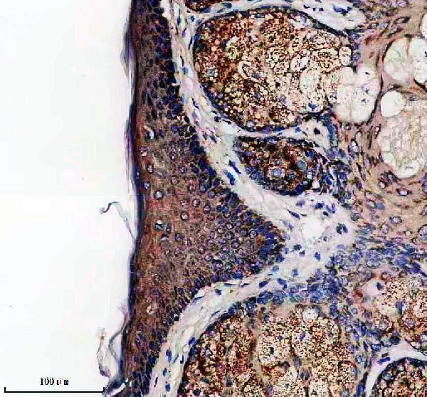 IHC analysis of Envoplakin/EVPL using anti-Envoplakin/EVPL antibody (A09421-1)