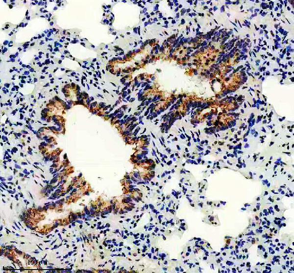 a09421 1 evpl primary antibodies ihc testing 3