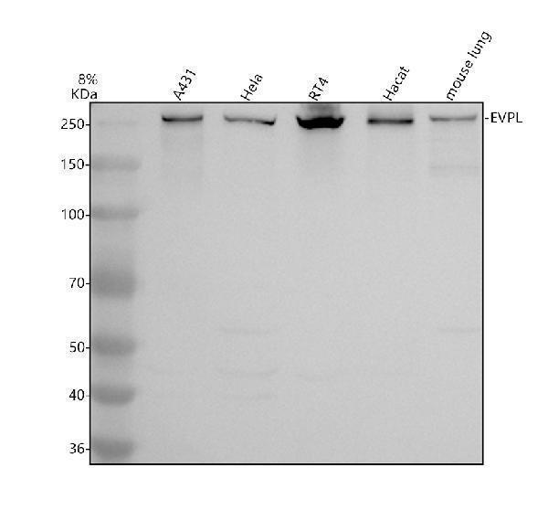 Western blot analysis of Envoplakin/EVPL using anti-Envoplakin/EVPL antibody (A09421-1)