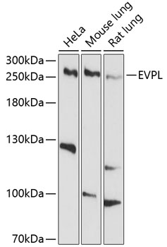 Western blot analysis of extracts of various cell lines, using EVPL antibody  at 1:1000 dilution