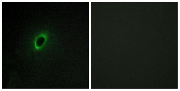 a09427 begain primary antibodies if testing 1