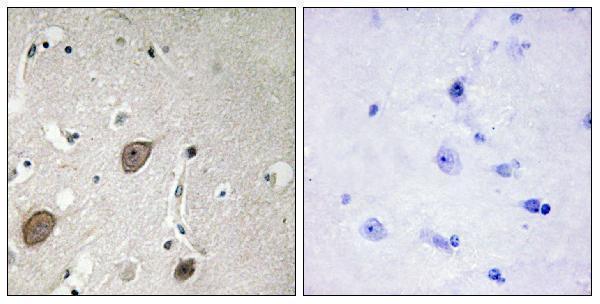 a09427 begain primary antibodies ihc testing 2