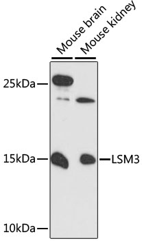 Western blot analysis of extracts of various cell lines, using LSM3 antibody  at 1:3000 dilution