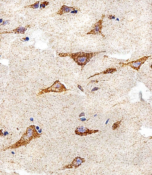 Immunohistochemical analysis of paraffin-embedded H