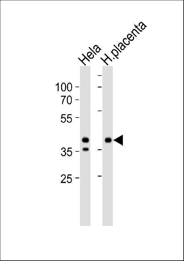 Western blot analysis of lysates from Hela cell line and human placenta tissue lysate (from left to right), using IDH3B Antibody (N-term)