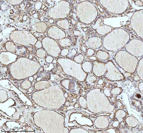  IHC analysis of IDH3B using anti-IDH3B antibody (A09433-3)