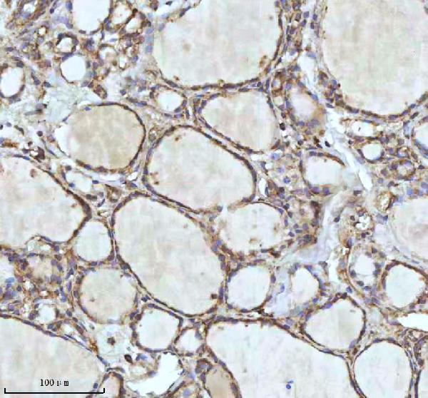 IHC analysis of IDH3B using anti-IDH3B antibody (A09433-3)