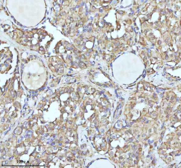 a09433 3 idh3b primary antibodies ihc testing 5