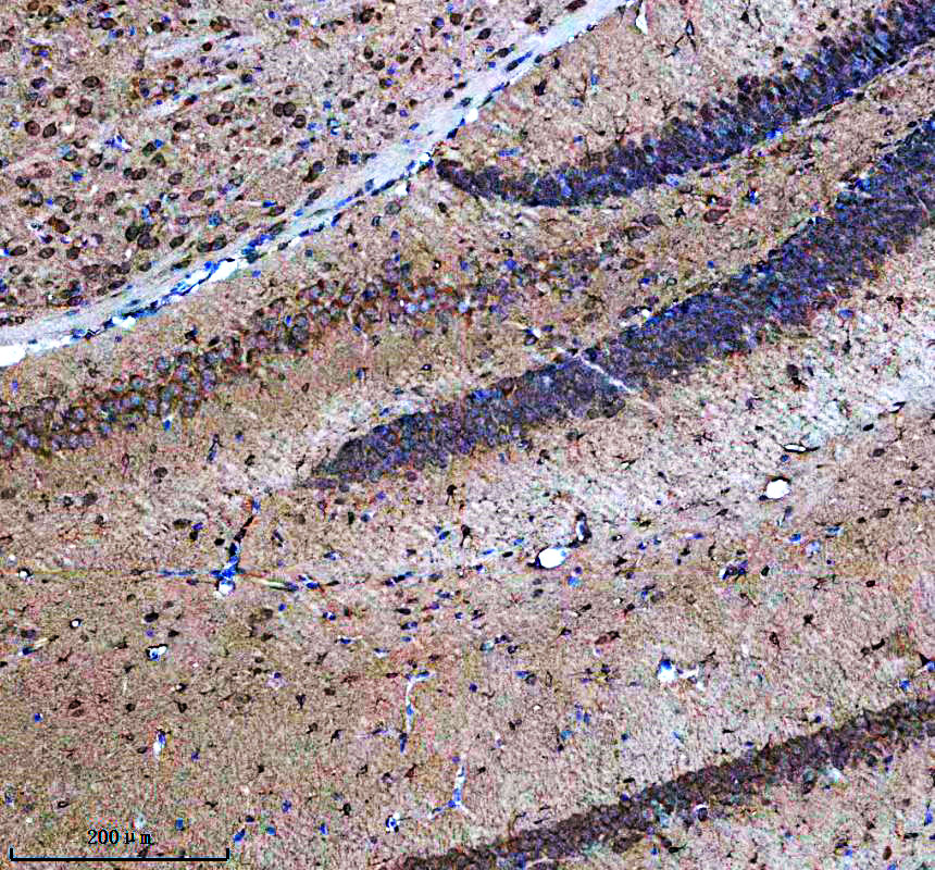 IHC analysis of JAKMIP1 using anti-JAKMIP1 antibody (A09437-1)
