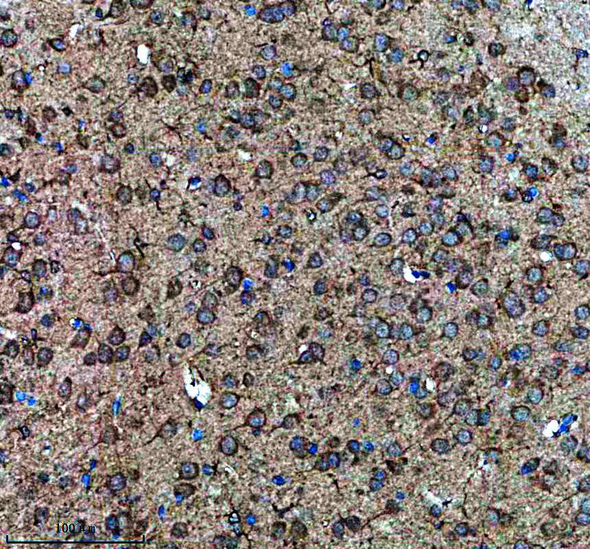 IHC analysis of JAKMIP1 using anti-JAKMIP1 antibody (A09437-1)