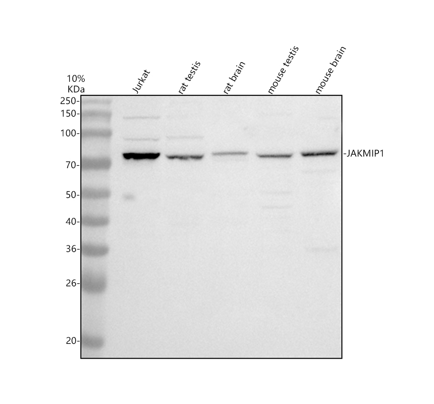 Western blot analysis of JAKMIP1 using anti-JAKMIP1 antibody (A09437-1)