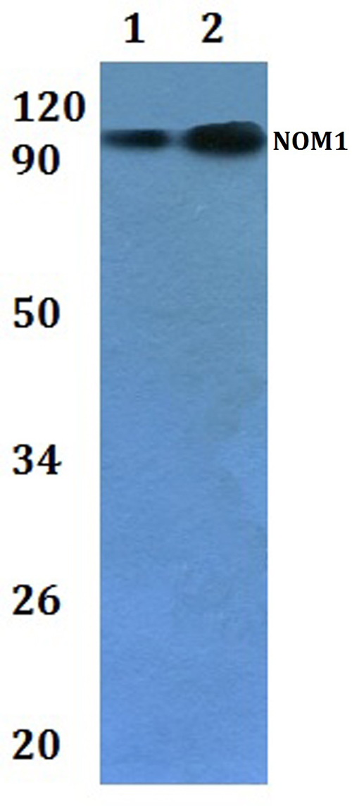 Western blot (WB) analysis of NOM1 polyclonal antibody at 1:500 dilution  Lane1:HEK293T whole cell lysate   Lane2:H9C2 whole cell lysate    