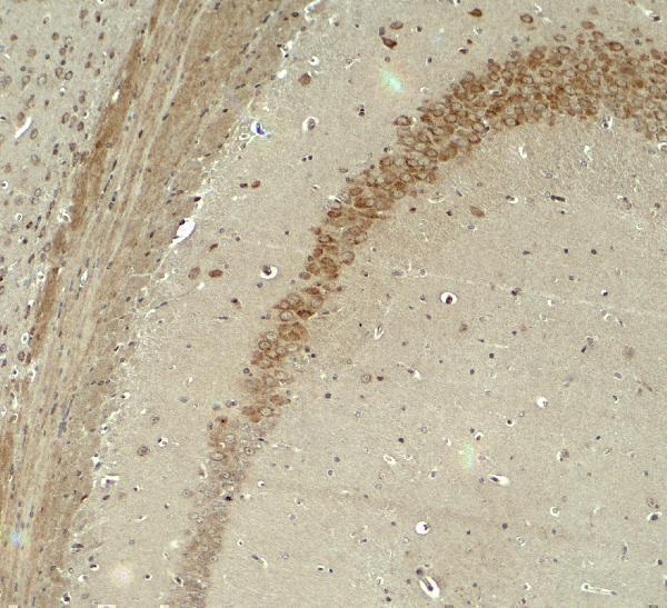 a09440 iqsec2 primary antibodies ihc testing 2