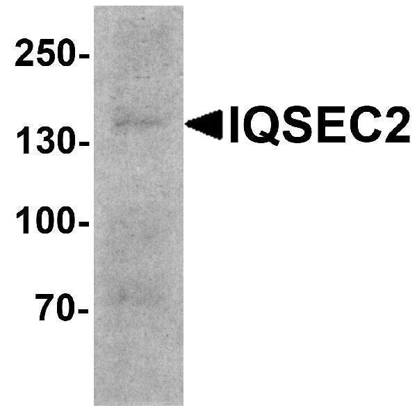 a09440 iqsec2 primary antibodies wb testing 1