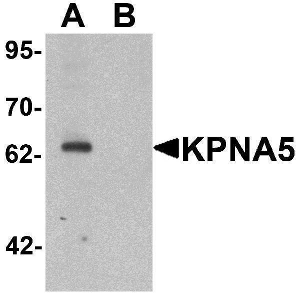 Western blot analysis of KPNA6 in EL4 cell lysate with KPNA5 antibody at 1 μg/mL in (A) the absence and (B) the presence of blocking peptide