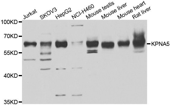 Western blot analysis of extracts of various cell lines, using KPNA5 antibody
