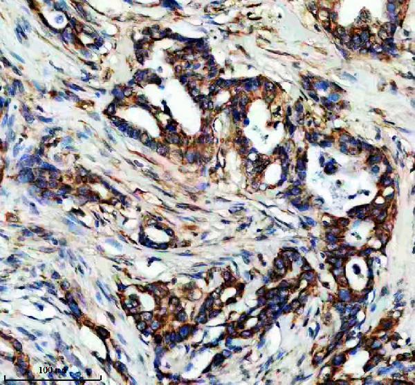IHC analysis of TMED2 using anti-TMED2 antibody (A09445)
