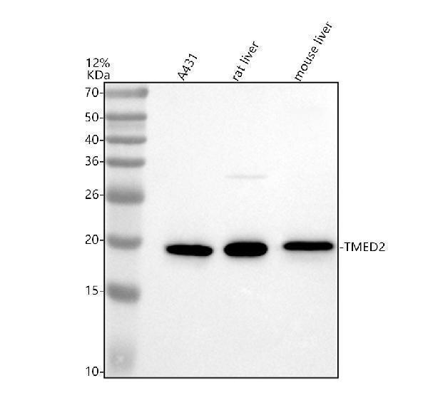 Western blot analysis of TMED2 using anti-TMED2 antibody (A09445)