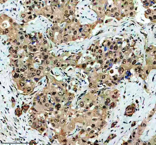 a09447 1 fbxo22 primary antibodies ihc testing 1