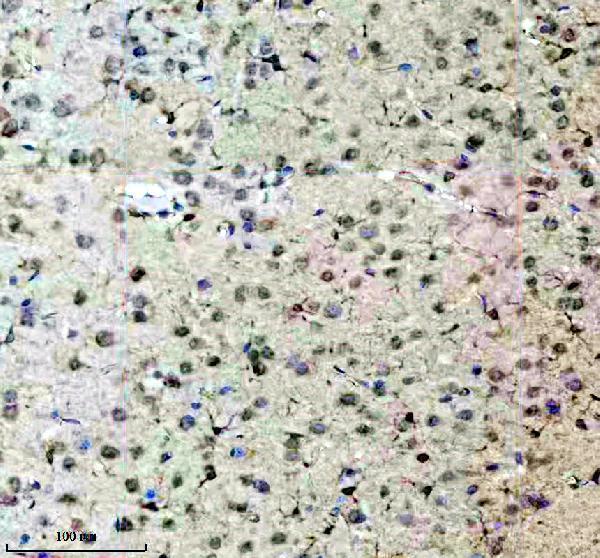 a09447 1 fbxo22 primary antibodies ihc testing 2