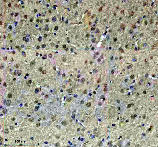 a09447 1 fbxo22 primary antibodies ihc testing 3
