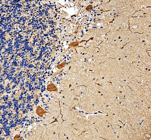 IHC analysis of OSBP2 using anti-OSBP2 antibody (A09455-3)