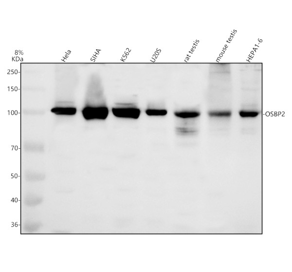 Western blot analysis of OSBP2 using anti-OSBP2 antibody (A09455-3)