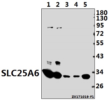 Western blot (WB) analysis of SLC25A6 (R155) pAb at 1:1000 dilution
Lane1:H1792 whole cell lysate(40ug)
Lane2:HepG2 whole cell lysate(40ug)
Lane3:The Testis tissue lysate of Mouse(40ug)
Lane4:The Testis tissue lysate of Rat(40ug)
Lane5:HEK293T whole cell lysate(20ug)