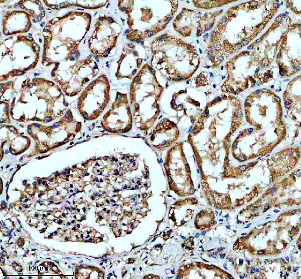 IHC analysis of SLC25A6 using anti-SLC25A6 antibody (A09457-2)