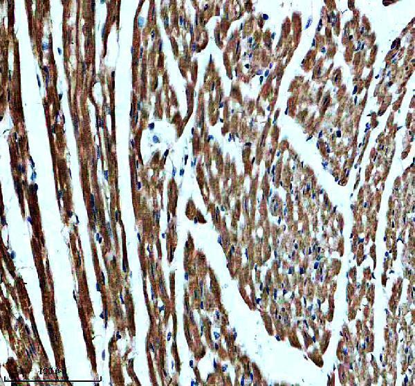 IHC analysis of SLC25A6 using anti-SLC25A6 antibody (A09457-2)