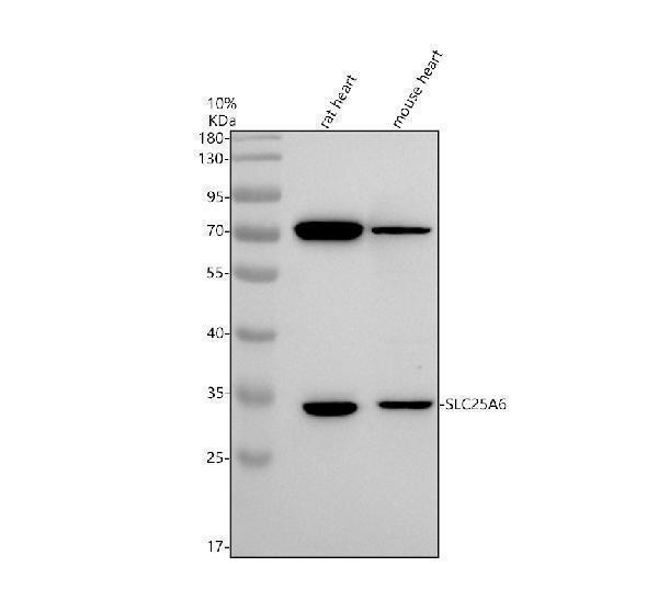 Western blot analysis of SLC25A6 using anti-SLC25A6 antibody (A09457-2)