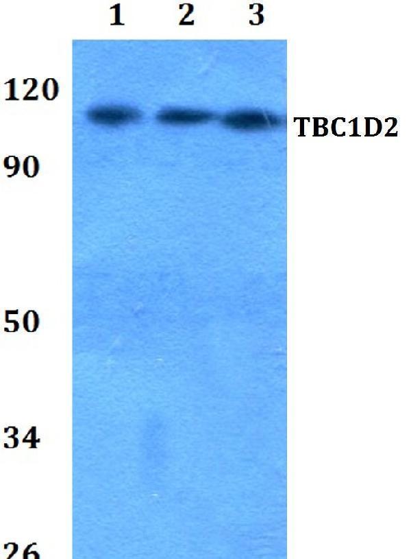 a09458 tbc1d2 primary antiboties wb testing 1