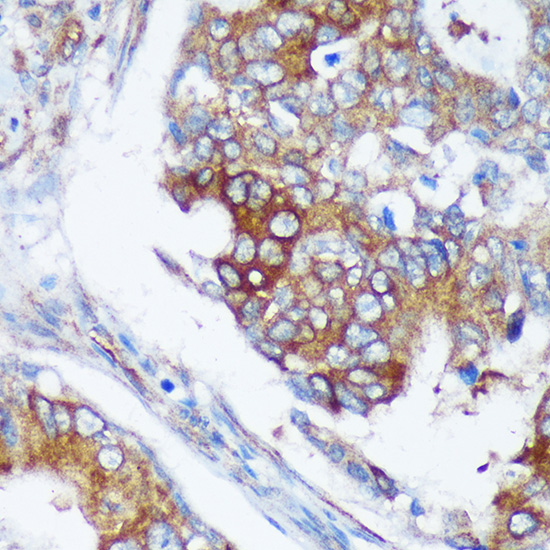 a09466 rabgap1 primary antiboties ihc testing 2