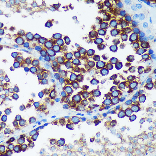 a09466 rabgap1 primary antiboties ihc testing 3