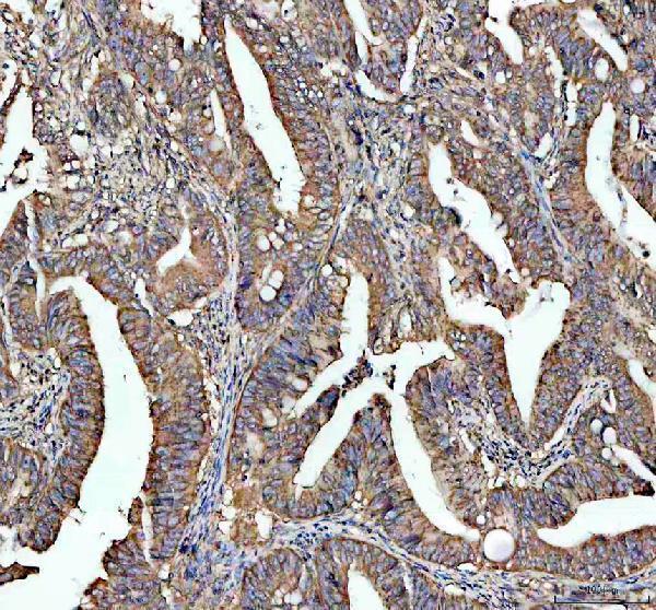IHC analysis of STRIP1 using anti-STRIP1 antibody (A09470-1)
