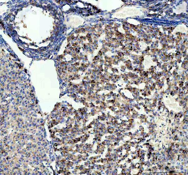 a09470 1 strip1 primary antibodies ihc testing 2_1